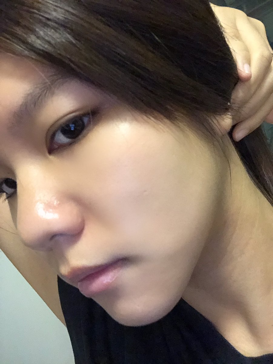 ppinkqx's tweet photo. เออแต่ช่วงนี้ชอบผิวหน้าตัวเองจริงๆนะ ชอบที่สุดละ เพราะมีช่วงนึง���หมือนแพ้อะไรสักอย่าง หน้าพังมาก สิวก็ขึ้น หน้าแหกมากจริงแม่ 

อันนี้ภาพเมื่อ 1/9/2019 และภาพตอนนี้ 
ถ่ายจากกล้องไอโฟนตอนกลางคืนมันอาจจะไม่ชัดเด้อ แต่ก็คือเออมันดีขึ้นเยอะมากๆ เลยอยากแชร์สกินแคร์ (ต่อ)
#พูพูReview👇🏻 https://t.co/qyU9vBqzAC