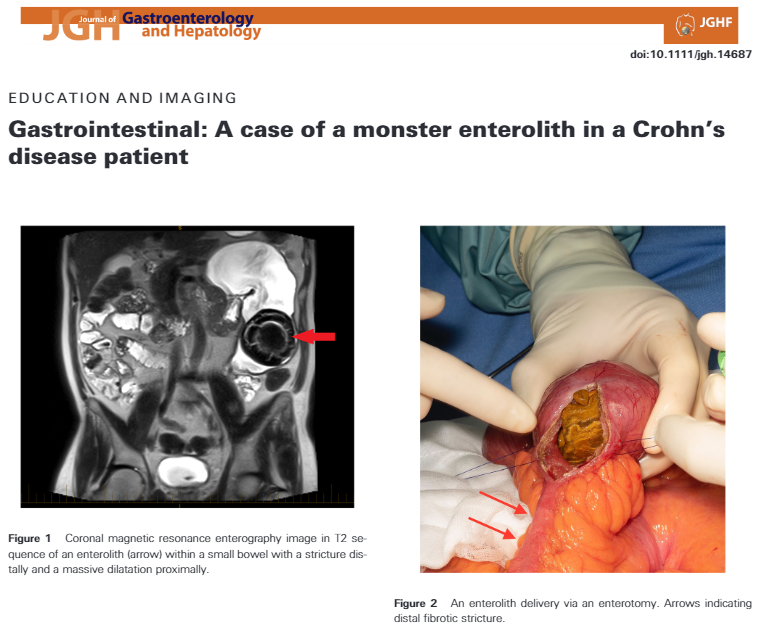 Dept Surgery & Critical Care University of Otago tweet media