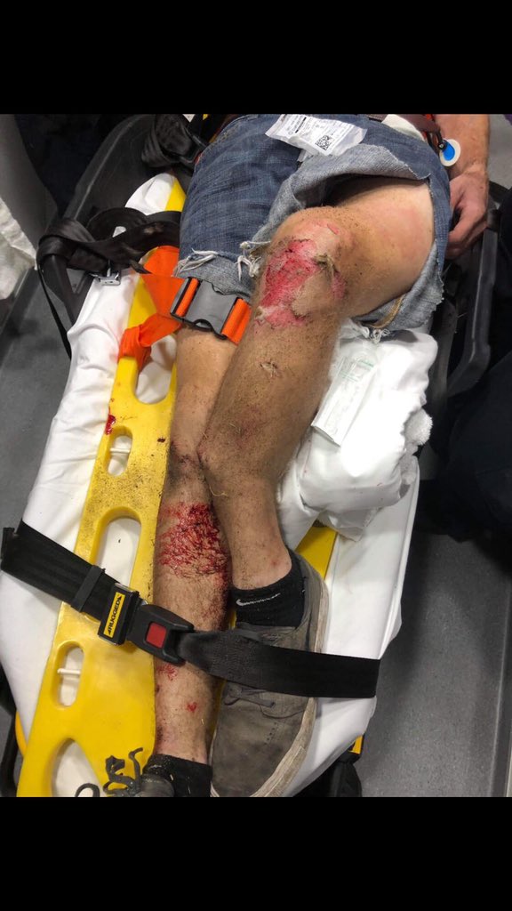 Itszushh's tweet photo. @MrRoyalty50 Some of the aftermath of the fall @TylerUher97 https://t.co/XgDtXzvtJc