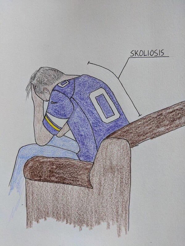 I don’t know about you, but we’re still dealing with “skoliosis” today following the whiplash-inducing interception that @KirkCousins8 threw yesterday. #skol #stillteamkirk #sportschiro