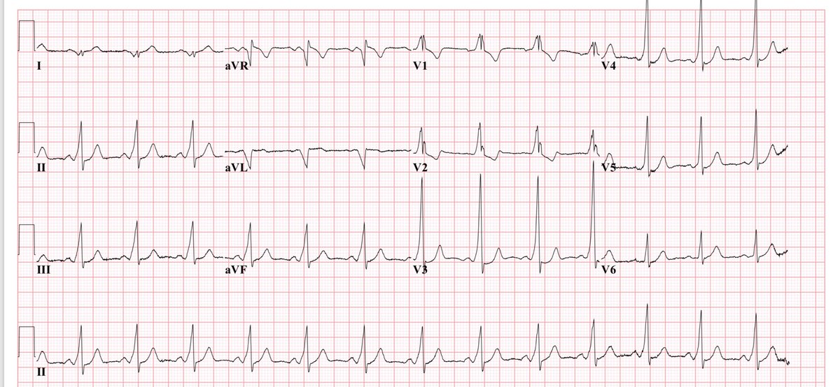 Mounir Basalus (Ⲃⲁⲥⲓⲗⲓⲟⲥ) tweet media