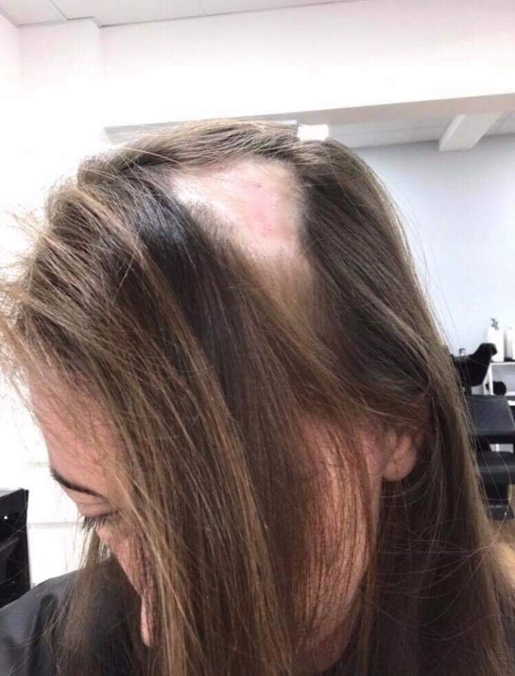 Hair Solved on Twitter: Hair Solved on Twitter:
