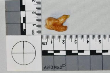 theAFOHR's tweet photo. #AFOHR #Odontologíaforense Objetivos sostenibles #FOSGs
OBJETIVO 4
#Odontologíaforensehumanitaria = Servicios dentales forenses pro bono. Use nuestra red internacional para mantener el soporte multinacional en la recopilación de datos de personas desaparecidas y no identificadas https://t.co/rz8I9T6p3p