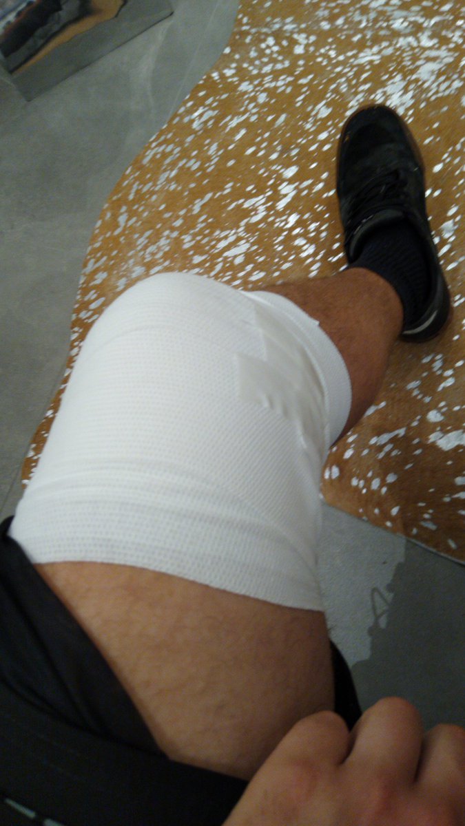 Freis73Freis's tweet photo. @tessamckinnonx Me knee knows what u r talking about https://t.co/0nAimRef6i