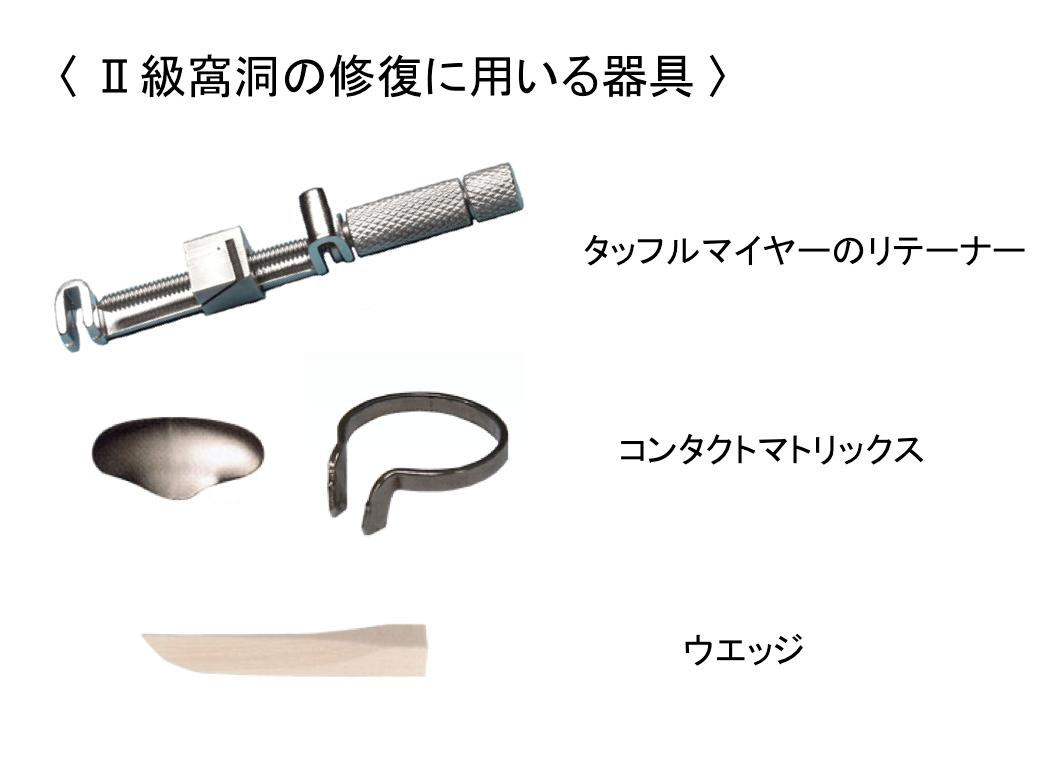 コンポジタイト 歯科 医療 歯隔壁 マトリックスバンドシステム 歯科器具