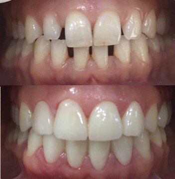 Dr.Hesna Huseyni (@hesnahuseyni) on Twitter photo 