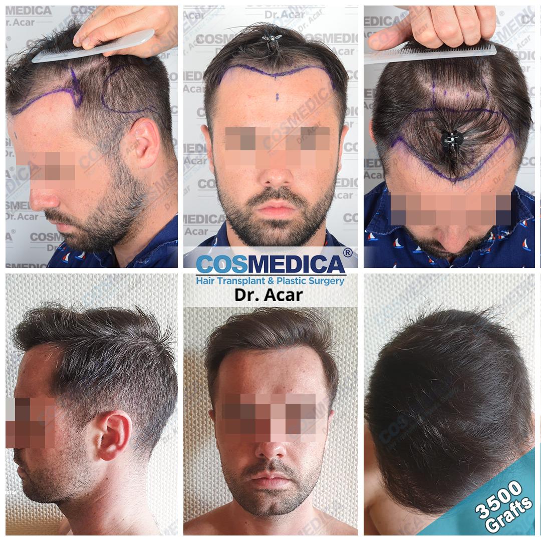 Cosmedica Clinic Twitterren: Cosmedica Clinic Twitterren: