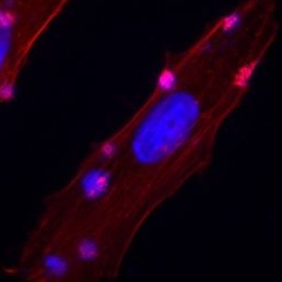 The latest from our neighbors…
The Rosenshine lab now shows how pathogenic E. coli (EPEC) adapts to host-adherent lifestyle!

mbio.asm.org/content/10/5/e…