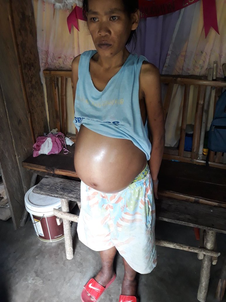 MarzanAron's tweet photo. Ayan po sya..Naaawa po ako sa ate ko na araw araw kong nakikita na umiiyak habang iniinda ang sakit...
#KMJS https://t.co/P4CVqrTjC4