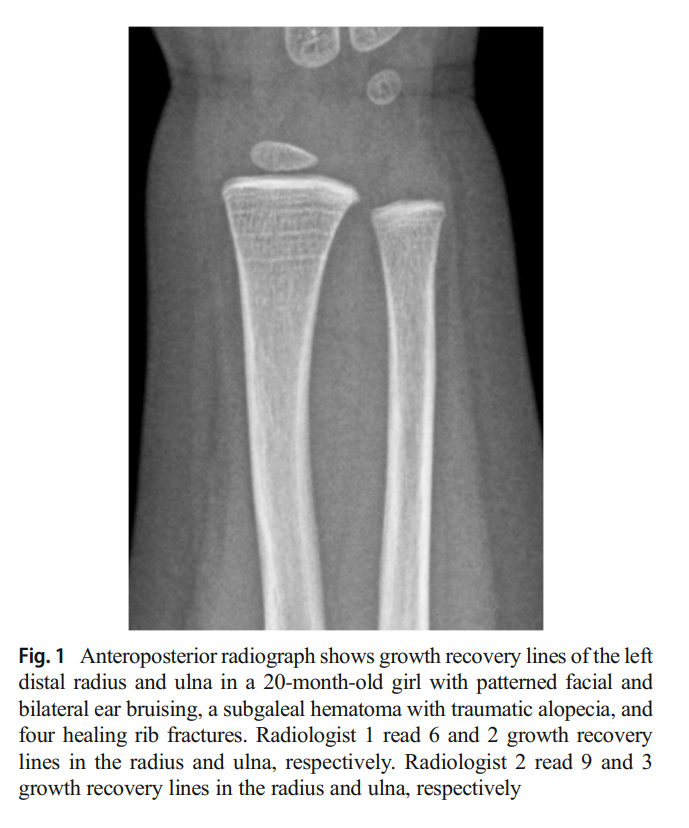 Wouter Karst tweet media