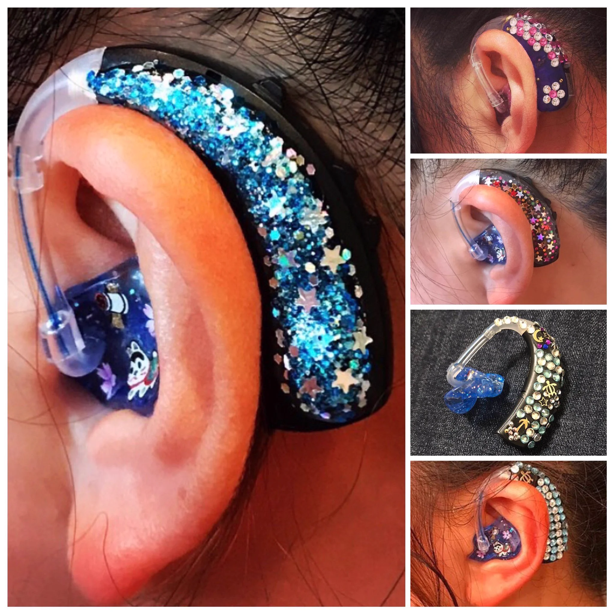 可愛すぎる補聴器！補聴器ユーザーの補聴器を隠したいという概念が覆るかも！