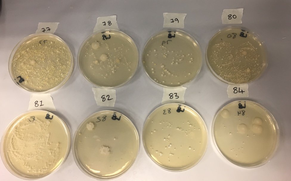 More hand bacteria results from Sunday's #uniopenday #biologyatyork #microbiology