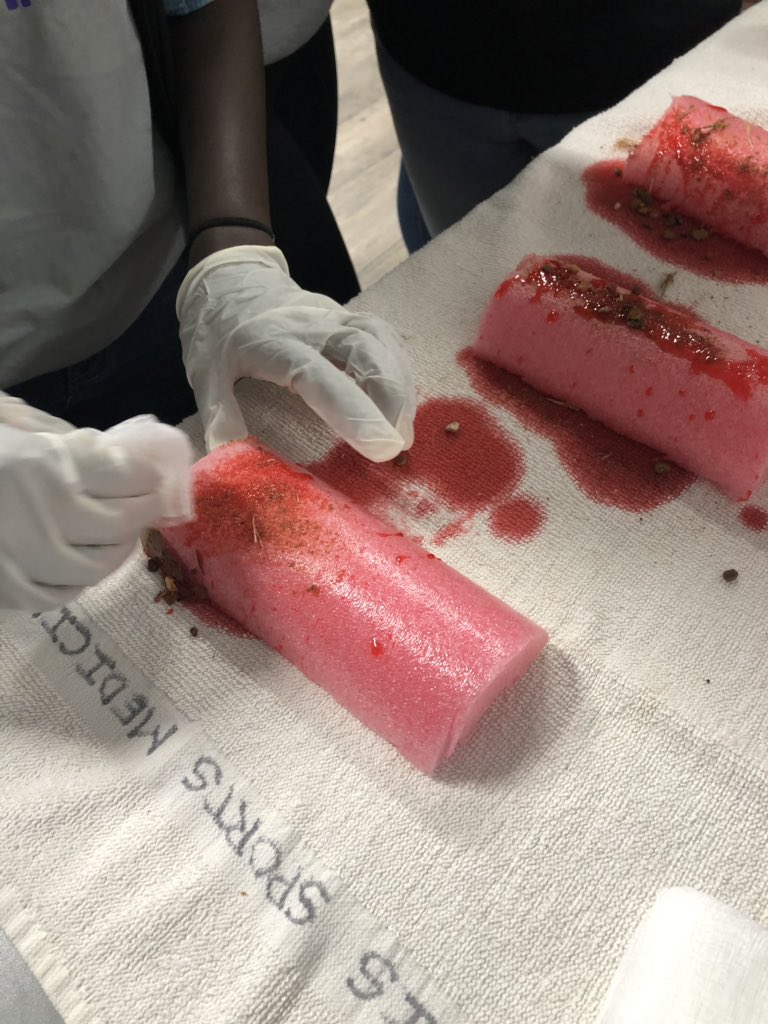 WHS_SportsMed17's tweet image. Our students completed a wound care lab, learning about various wounds they’ll see and how to properly treat them @ScottyMac94 
#wildkATs #woundcare #poolfloaties #strawberrysyrup