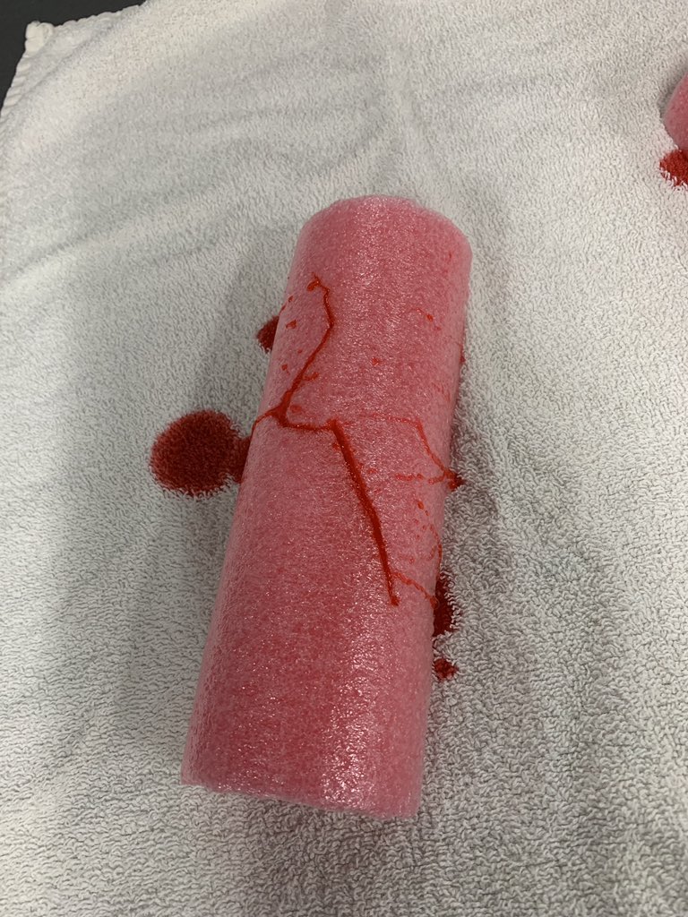 WHS_SportsMed17's tweet image. Our students completed a wound care lab, learning about various wounds they’ll see and how to properly treat them @ScottyMac94 
#wildkATs #woundcare #poolfloaties #strawberrysyrup