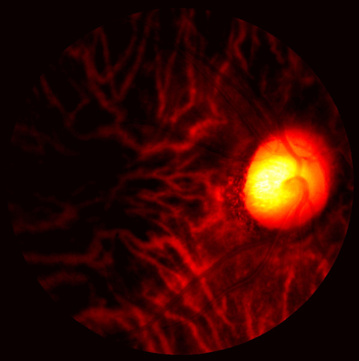 EyeResearchAus's tweet photo. MEDIA RELEASE: Eye scan sheds new light on Alzheimer's disease. Research in @NatureComms @PetervanWinga2 @XavierHadoux @UniMelbMDHS https://t.co/uOlJV12fSS #dementia #Alzheimers https://t.co/XU3AwWjF9z