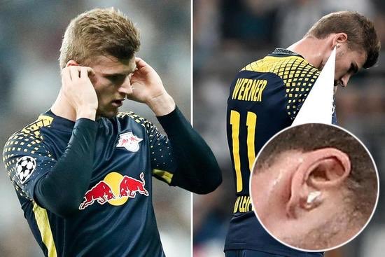 Timo Werner Kulak Tıkacı