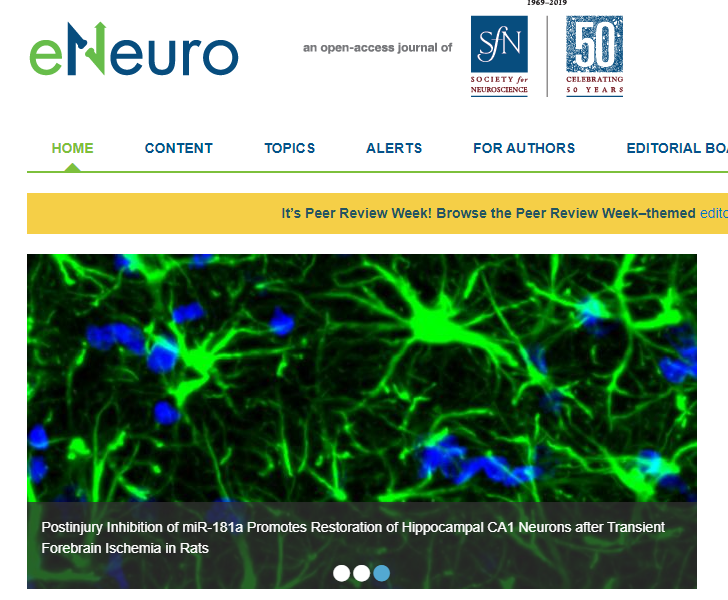 StaryLabs's tweet photo. An image from our recent manuscript is featured on the eNeuro homepage for two weeks! https://t.co/ZLfQLTkx6A