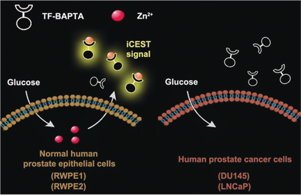 angew_chem's tweet photo. Development of Zinc-Specific iCEST MRI as an Imaging Biomarker for Prostate Cancer (Bulte) @HopkinsMedicine #ImagingAgents https://t.co/HfhlpjcFdQ https://t.co/gn04WAZXyL