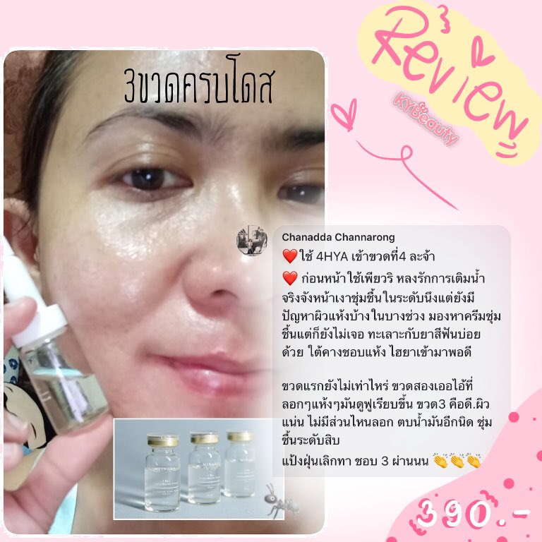 KYBeauty08's tweet photo. จะกี่คำบอกเล่าก็ไม่เท่าลองใช้เองนะ ช่วงนี้พี่มีโปรนะจ๊ะ #4HYA 💦 #สั่ง2แถม1 แล้วจะรู้ซึ้งถึงคำว่า #ผิวแข็งแรง ปกติเซ็ตนี้ราคา 1,170 แต่วันนี้จ่ายเพียง 780‼️

หมดเขต 09/10/19 นะจ๊ะ
#เตาปู��� #บางซื่อ #สวนลุม
#สถานีBTS #สถานีMRT
สั่งซื้อ | สอบถามปัญหาผิว 
➡️ https://t.co/FHXAjh1X7k https://t.co/xPN9iZy0a2