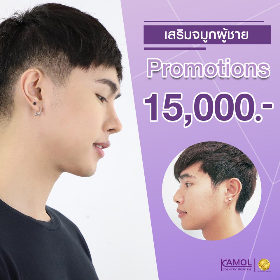 KamolHospitalTH's tweet photo. เสริมจม���กผู้ชาย..จมูกพุ่งปัง 
ปรับรูปหน้าให้ดูหล่อ มีมิติ 
เพียง  15,000 บาท

👉02-559-0151 / 094-5234512
👉FB : โรงพยาบาลกมล
👉Line: @kamolhospital
👉IG : kamol_hospital

#เสริมจมูกผู้ชาย #จมูกผู้ชาย #แก้จมูกผู้ชาย 
#เสริมจมูกหมอกมล #หมอกมล 
#โรงพยาบาลกมล #Kamolhospital https://t.co/pqxAcuFBMw