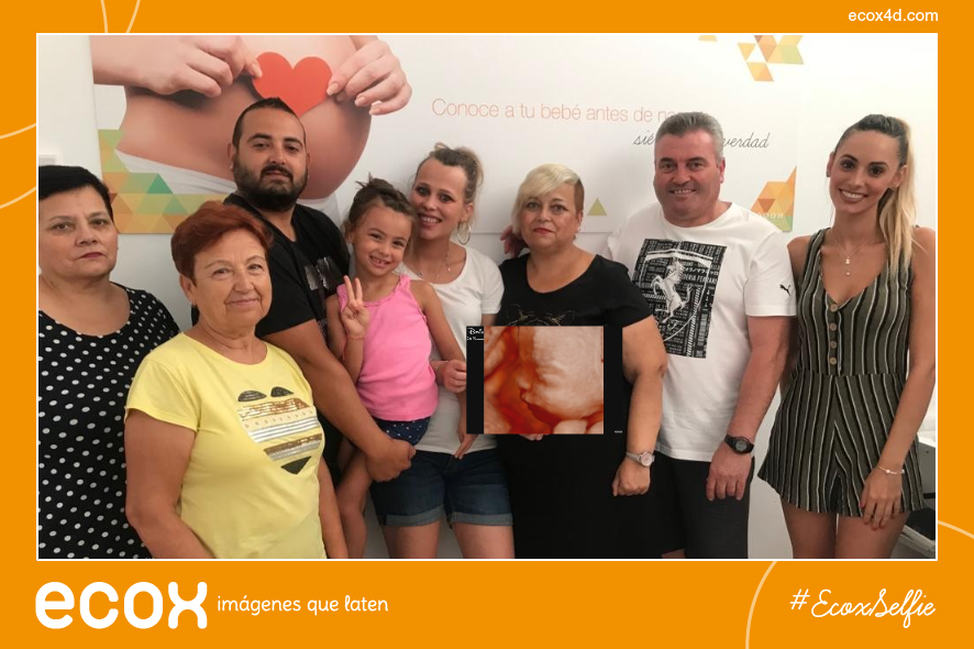 Papá, mamá y toda la familia no quiso perderse la oportunidad única de conocer con 26 semanas a la pequeña Cristina en #ecoxorihuela #ecografia #ecografia5D #bebe #maternidad #embarazo #sesionembarazo #ecoxselfies #ecox