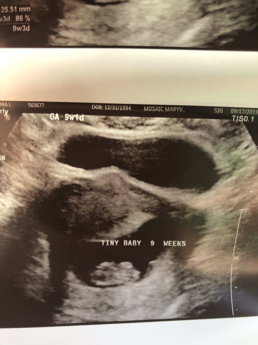 Alexander_2719's tweet photo. I never thought a picture could mean so much to me. Can’t wait to find out what you are❤️ https://t.co/NveCY4teLW