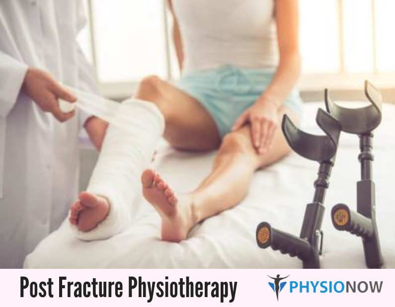 physio_now's tweet photo. Our physiotherapists are trained to assess all of the side effects of the fracture and develop an individualized treatment plan for you to get you back to your life as quickly. Contact us to book a consultation! https://t.co/2QToCoamxV https://t.co/XPmooPsSw9