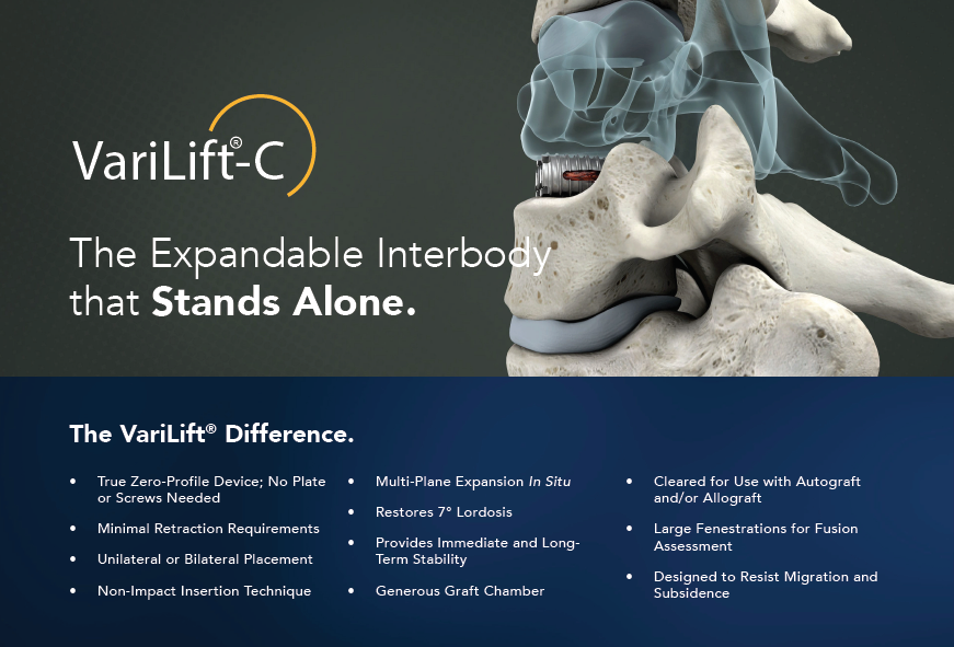 WenzelSpine's tweet photo. #simplifyspine #VariLiftC #standalone #MIS #expandable #IBFD https://t.co/ifrWUbVKLs