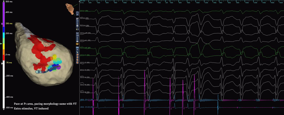 Murphy Lyu tweet media