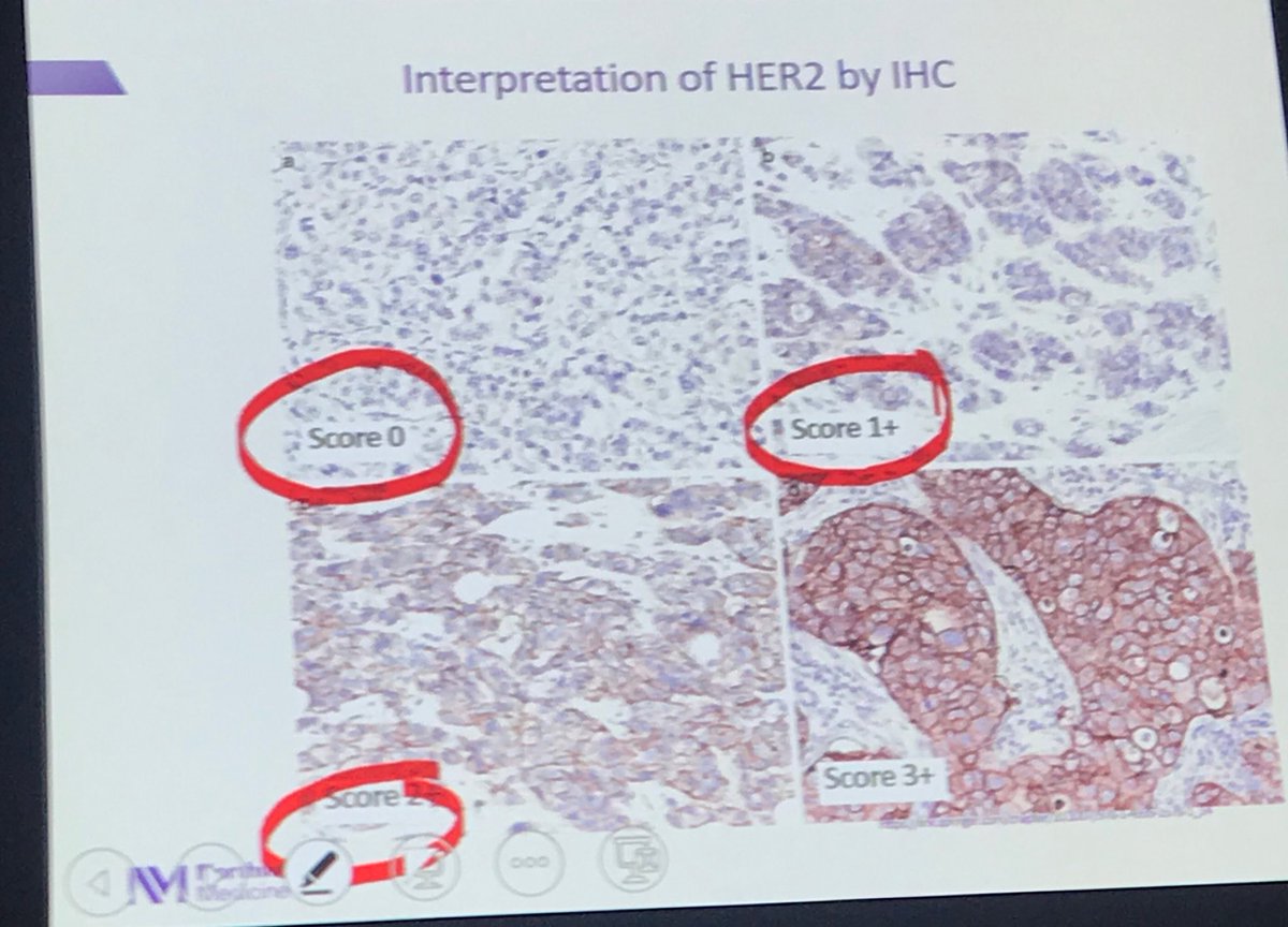 DrWGradishar's tweet photo. Popi Siziopikou leading path session this afternoon on HER2 testing...⁦@LurieCancer⁩ #LSB2019 https://t.co/0Wxgv28i3Q