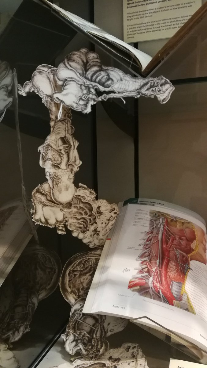 LucyLyons's tweet photo. After 7 hours & lots of help from the amazing team at @RCPmuseum the work is installed #ImpossiblePathologies is part of the #UnderTheSkin #RCPUnderTheSkin exhibition opening 10th Oct - 3rd April
#Art #ArtAndMedicine #Drawing #Anatomy #AnatomicalArt #Pathology #PathologicalArt https://t.co/YhRrwsGs17