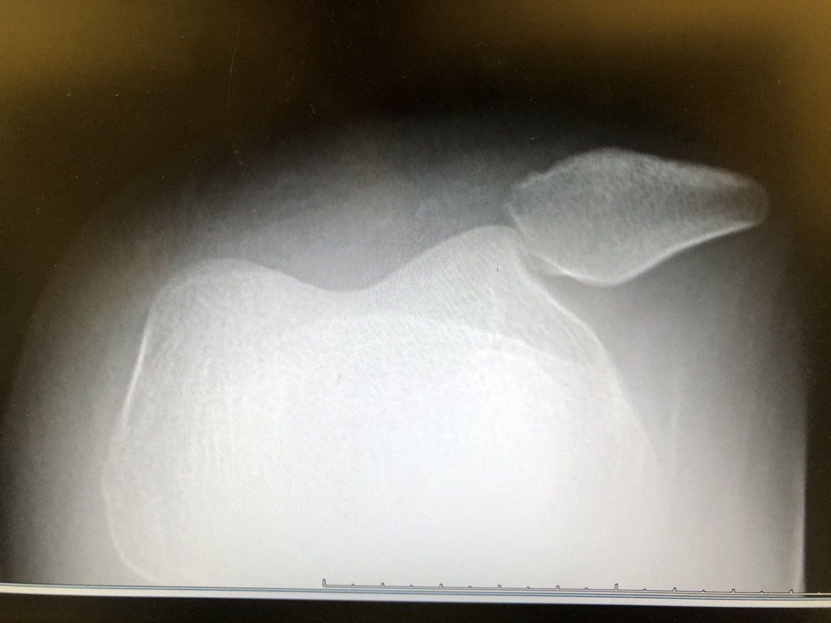 B. Christian Balldin, MD tweet media