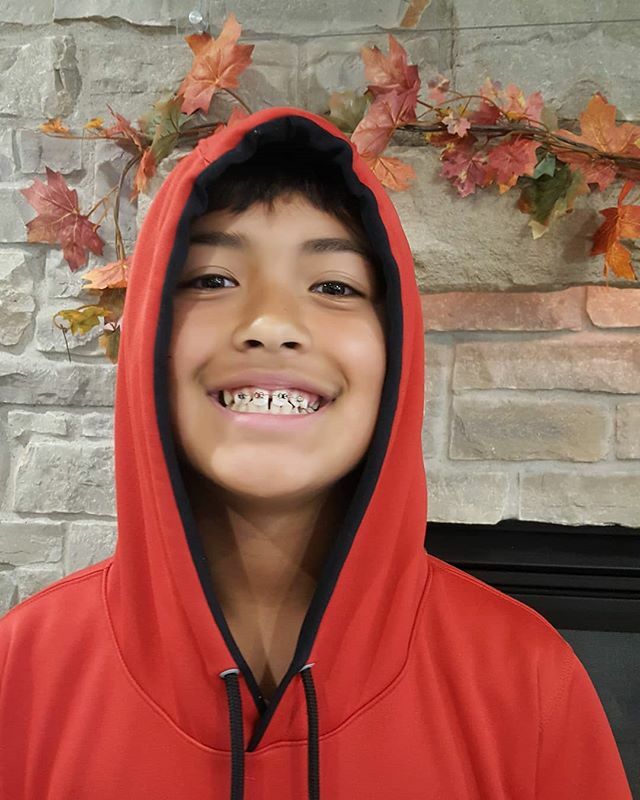 GLKSmiles's tweet photo. Isaac sure looks cool with braces! We're so excited for you to be on this journey with us! Congrats, bud! #glkorthodontics #braceson #getasmile https://t.co/WsgPyYz4sa https://t.co/O5pVroUzPX