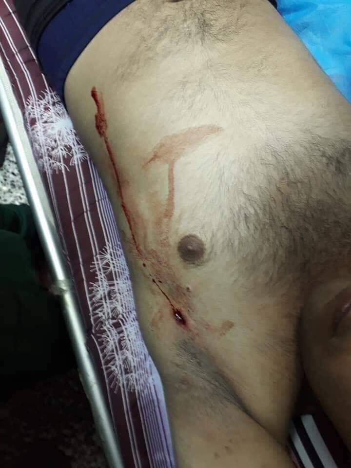 HNabeel's tweet photo. اشك بالشخص الي يضرب هؤلاء المتظاهرين يكونون من الشعب الارجنتيني و إلا مستحيل عراقي صاحب مبدأ يتصرف بهالطريقة و يأذي ابناء بلده الي ديطالبون بحقوقه #ساحه_التحرير https://t.co/yNYv06ZbO0