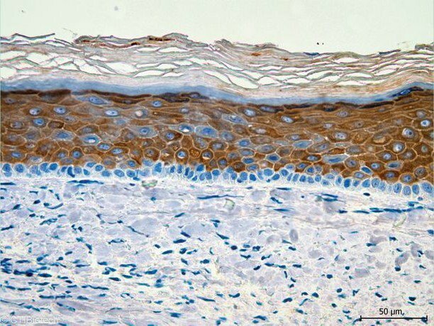 3dheals's tweet photo. BASF and CTIBiotech: First 3d bioprinted human skin including immune macrophages @BASF @ctibiotech #3dprinting #bioprinted #skinmodels #immunemacrophages #bioactives #tissueregeneration #tissueengineering #technology #JointheTribe https://t.co/EUCmEBrgpL https://t.co/aEUnSS0Pli https://t.co/YOXdTZFSzN