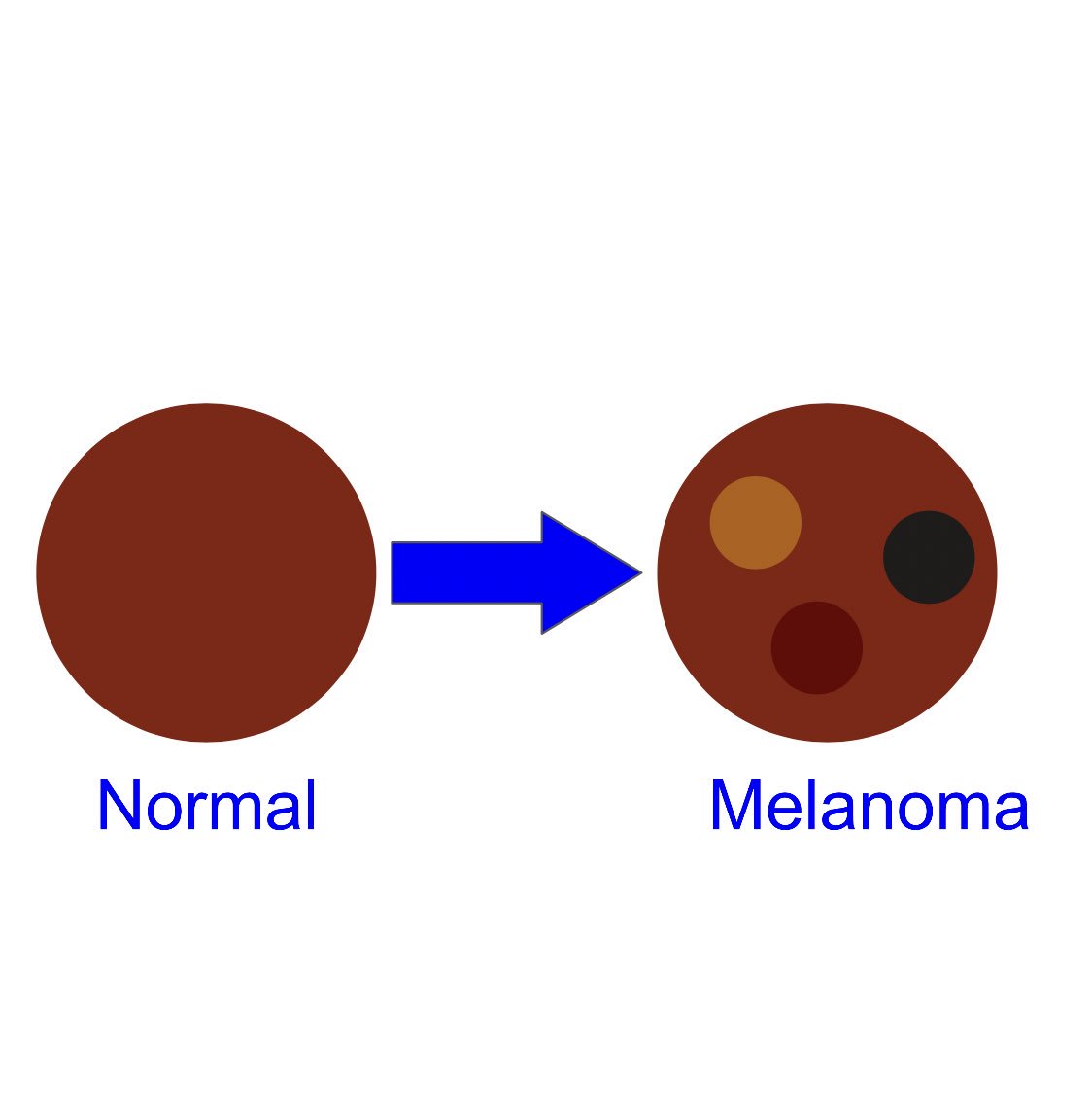 _helms_hope's tweet photo. C is for color.
A normal spot will usually be a shade of brown or black. A color change is never a good sign (get it checked by a 👨‍⚕️!) The colors can vary from red, brown, tan, and black. If it is multicolored, it should also be looked at by a doctor! https://t.co/MUAAKv2jAN