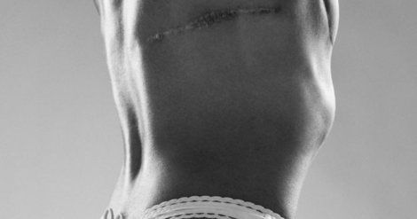 SanteMDoctor's tweet photo. Santé> Seins > Dix femmes atteintes de cancer posent pour des spot https://t.co/ZeuKkXL95h #docteur https://t.co/XIbI5a4fIh