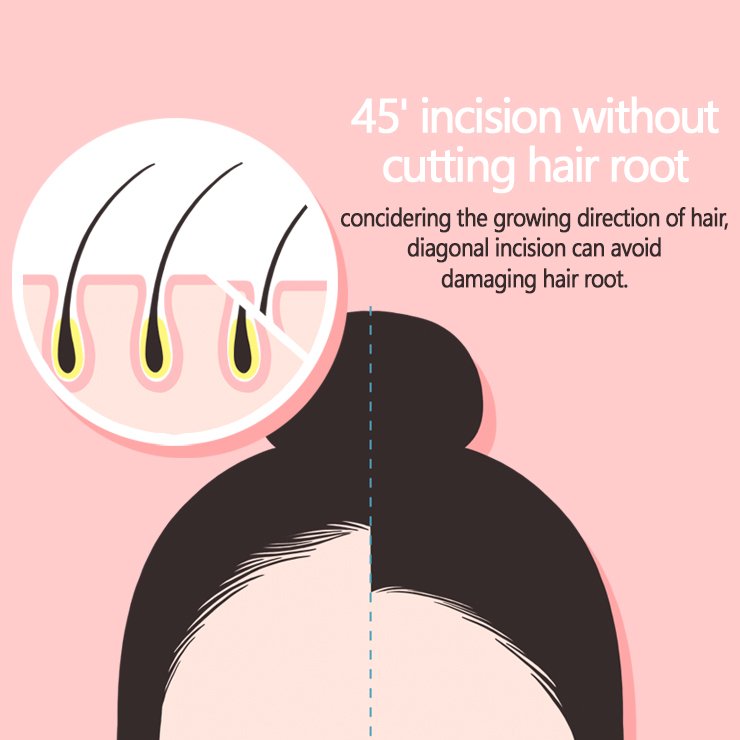 BoneeyePlastic's tweet photo. 💞 Forehead lift for perfection

#boneeye #Dr_Moon #foreheadlift #forehead_lift #facelift #antiaging #koreansurgeon #koreanclinic #koreanplasticsurgery #roundforehead #korea #gangnamstyle https://t.co/c5UOucUXnB