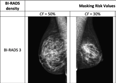 New research on a masking risk model to make better use of a #mammogram: bit.ly/2nR9Km2 @uvahealthnews @sunnybrook #breastcancerawareness #BreastCancerMonth #WednesdayWisdom
