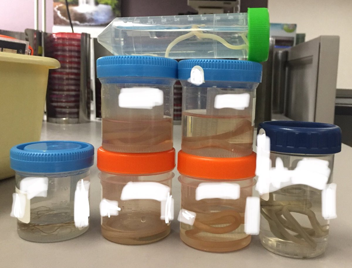 My parasite collection grows 😈 #pathology #parasite <a href="/ParasiteGal/">Bobbi Pritt, MD</a>
