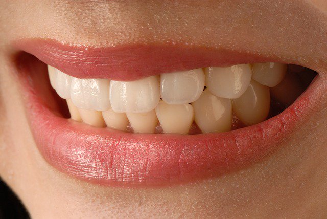 Smile with confidence! Dental implants are designed to provide a foundation for replacement teeth that look, feel and function like natural teeth. Learn more: http://ow.ly/2I9N50w2S5x
#admiredental #dentist #springfieldma #oralhealth #smile