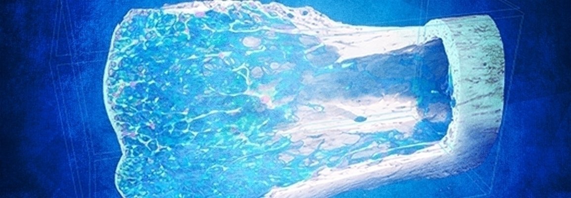 bruker's tweet photo. Register now for this #preclinicalimaging webinar on Oct 24th: "Longitudinal 4D monitoring of bone mass and architecture and (re)modeling events using in vivo #microCT" @RoyalVetCollege @UoLondon #boneimaging #murinebone https://t.co/X0AQlHbCvQ https://t.co/z7E8LQZFDP