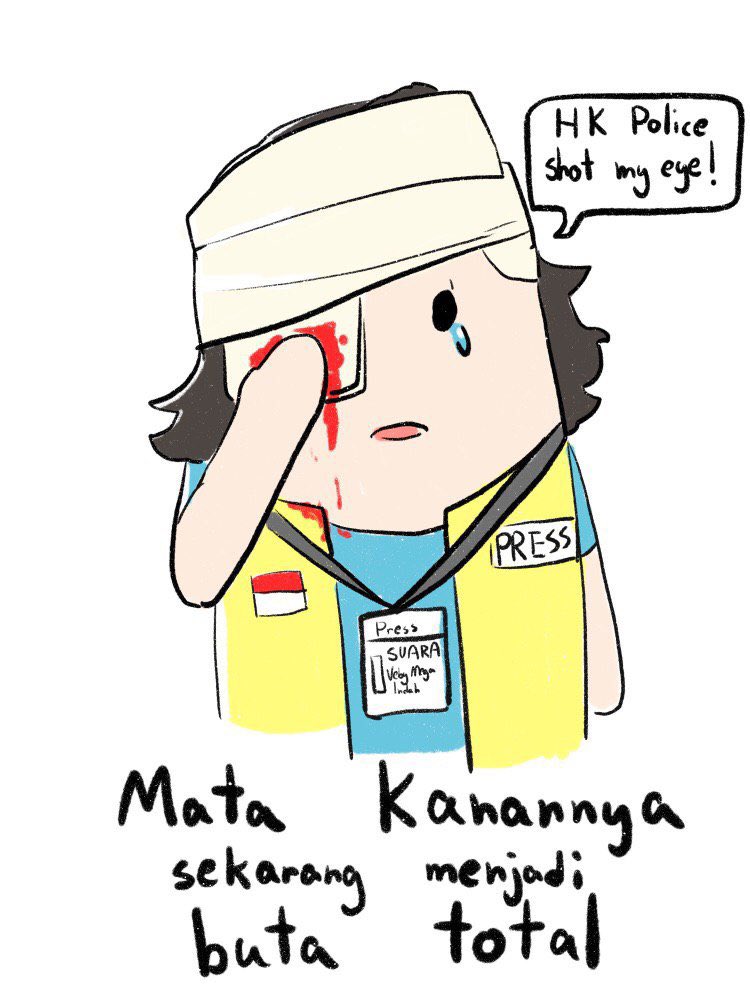 smallpotato_02's tweet photo. HK police force has became the terrorist!
They shot the journalist and took away her right eye! 
#antitotalitarianism #StandWithHongKong #HongKongProtests #hkpolicebrutality https://t.co/QMahSl2UsF