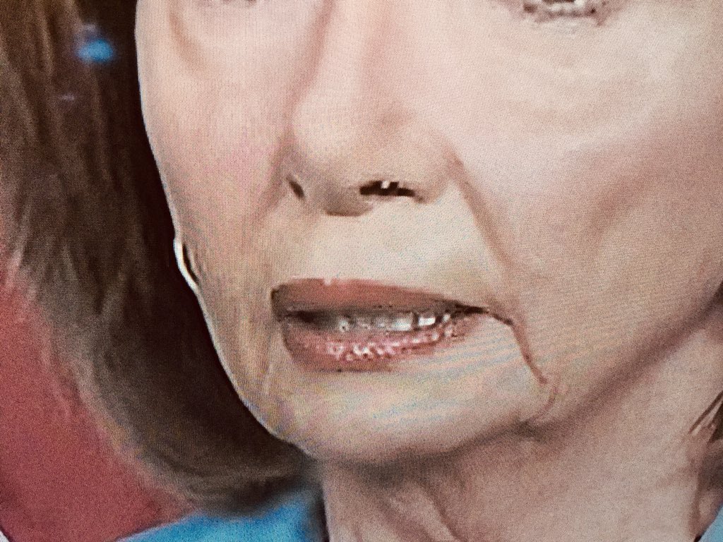 Looks like Nancy Pelosi's nose is falling apart again, or she has a booger
