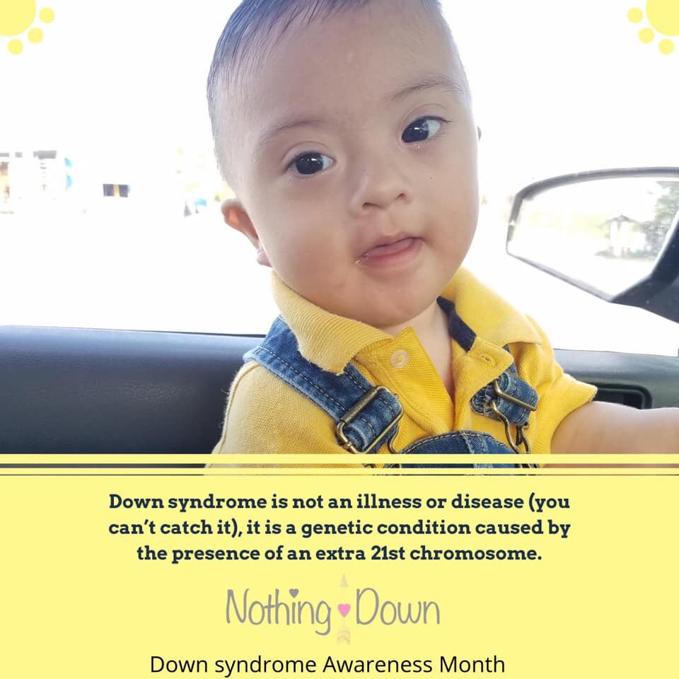 NothingDownOrg's tweet photo. 💙Down Syndrome Awareness Month Fact💛

Down syndrome is not an illness or disease. You can't catch it.  It's a genetic condition caused by the presence of an extra 21st chromosome. 

#NothingDown #DownSyndromeAwarenessMonth #morealikethandifferent https://t.co/ofYF1RlK4v