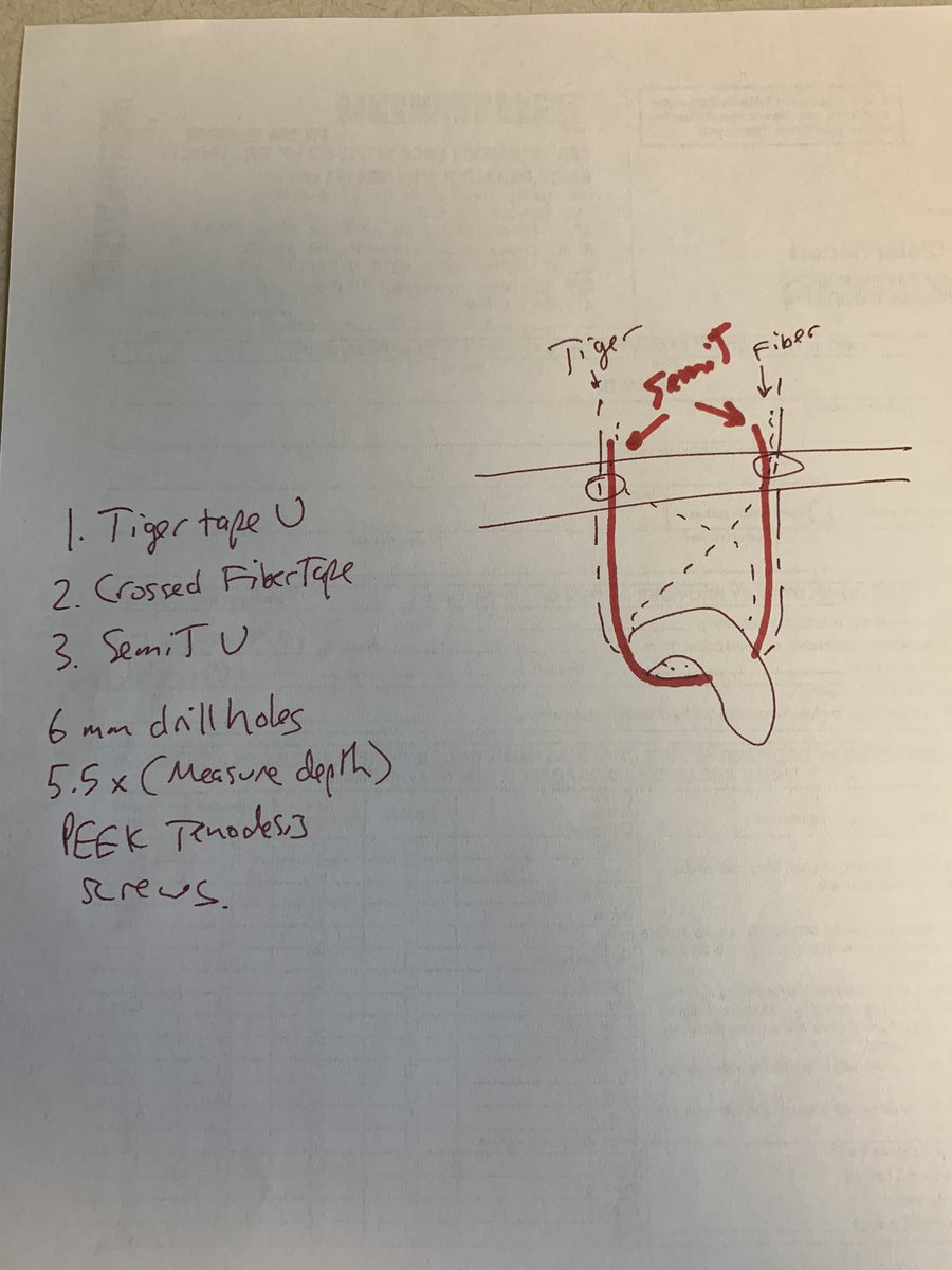 shouldergeek's tweet photo. @jointdocShields I showed my partner how I reconstruct the coracoclavicular ligaments.
I had similar concerns.
It’s a #coracoid, people. https://t.co/B5o2rKd0LI