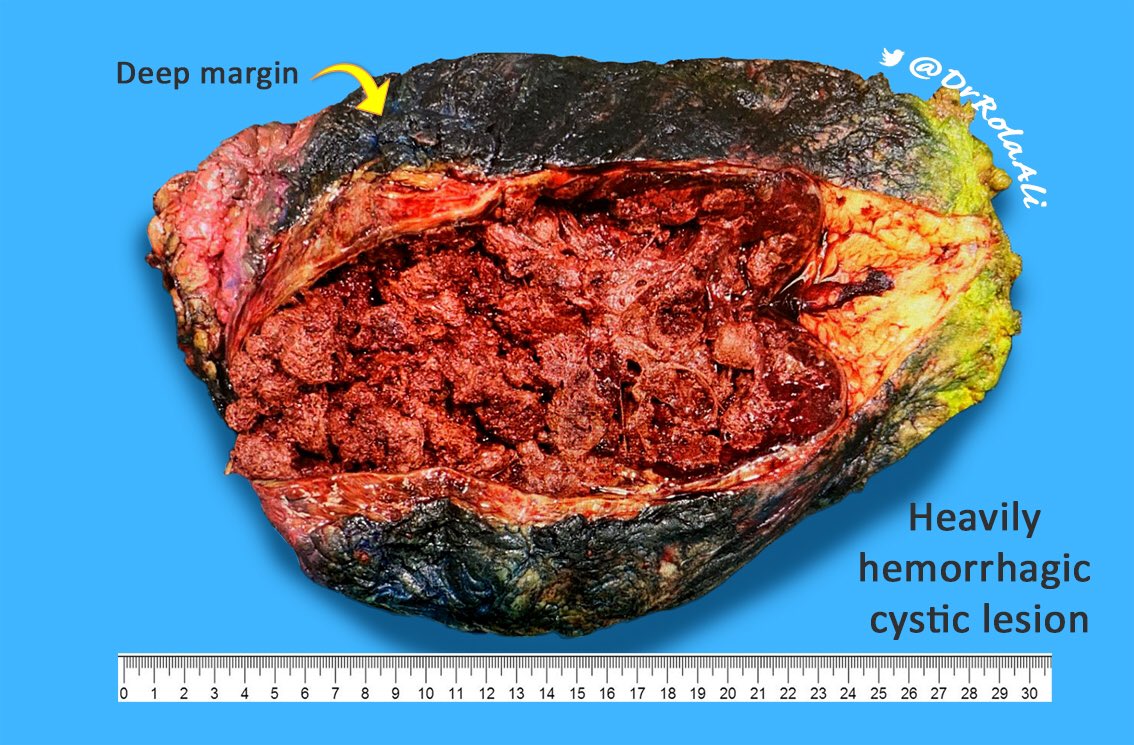 Rola Ali, MD tweet media