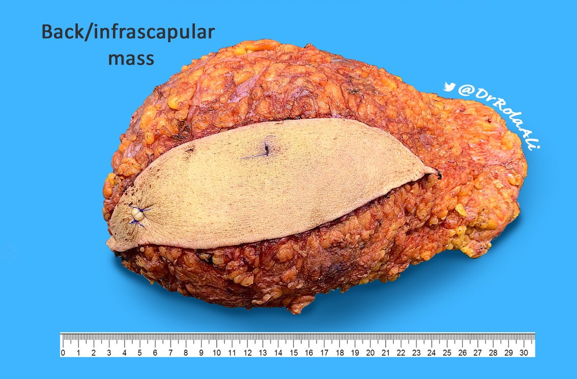 Rola Ali, MD tweet media