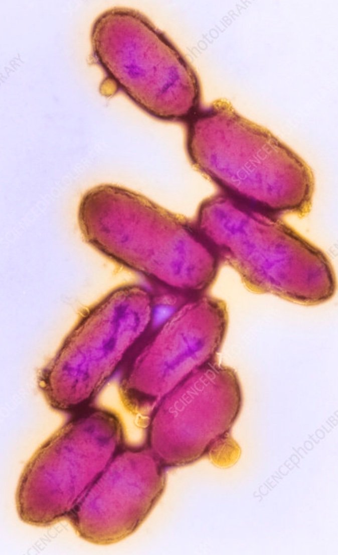 возбудители бактериальных инфекций чумная палочка. палочка иерсиния пестис чумная. чумная палочка бактерия. бактерия чумы название. бактерия чумы название.