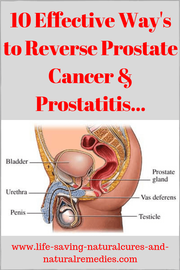 Prostatitis máj